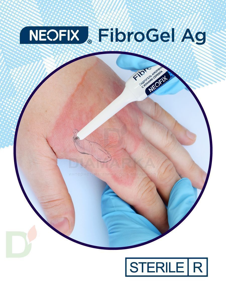 Гидрогель антимикробный NEOFIX FibroGel Fg с ионами серебра 15г в Ставрополе